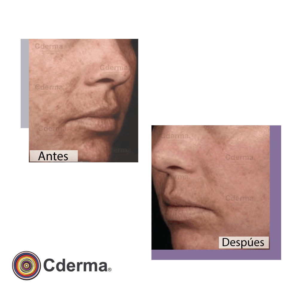 Dermatología Cderma